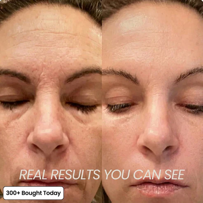 🔥BUY 1 GET IFREE🔥PDRN Pink Collagen Volume Multi Balm