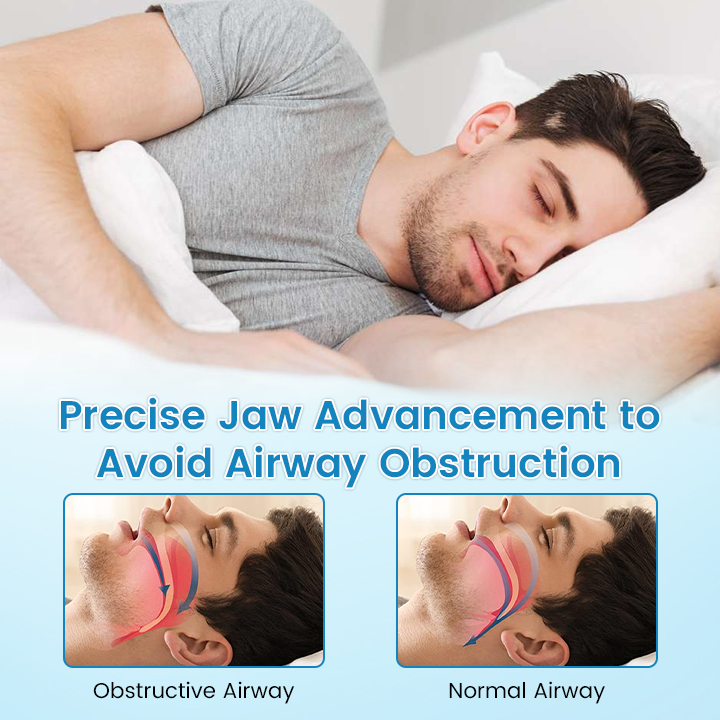 ✨Sunlitglen™ Anti-Snoring & Anti-Grinding Teeth Protector