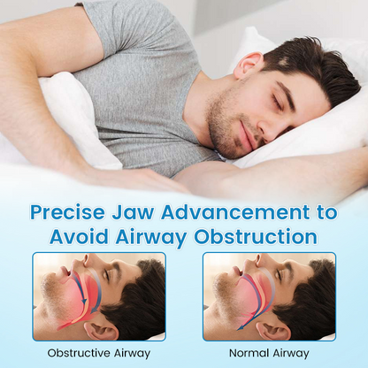 ✨Sunlitglen™ Anti-Snoring & Anti-Grinding Teeth Protector