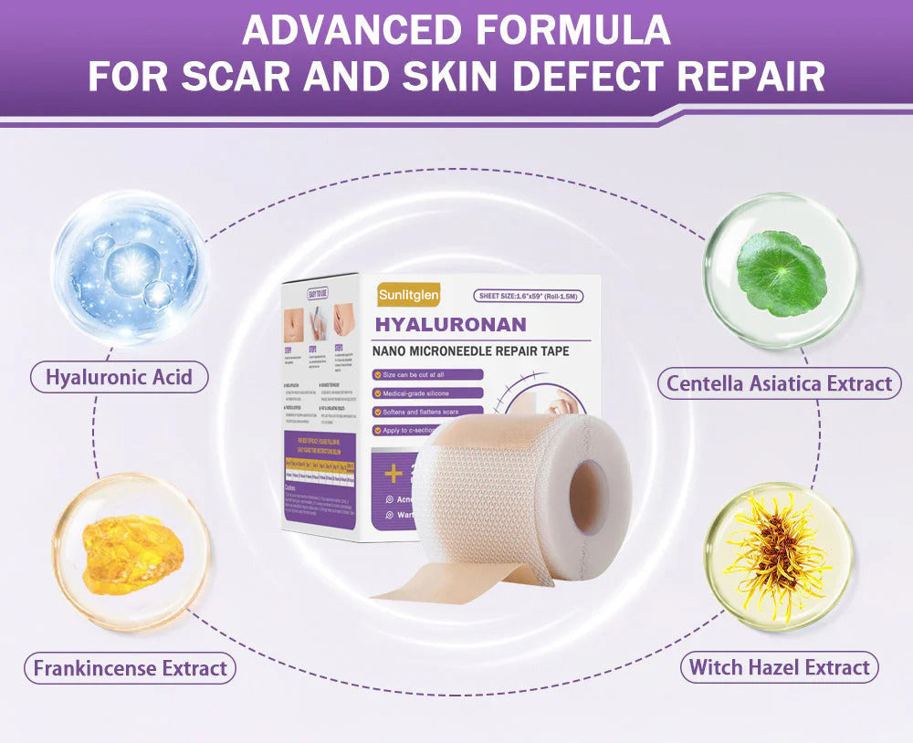 ✅Official Store |Sunlitglen® Hyaluronan Nano Microneedle Repair Tape🏥 (Treatment of old and new scars, reduction of surgical scars, stretch marks, keloids, acne, burns, warts, dermatomes and varicose veins)