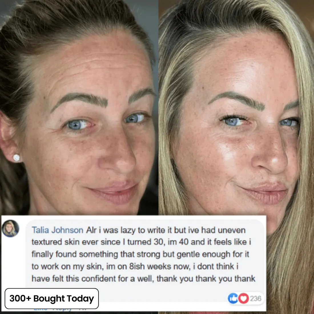 🔥BUY 1 GET IFREE🔥PDRN Pink Collagen Volume Multi Balm