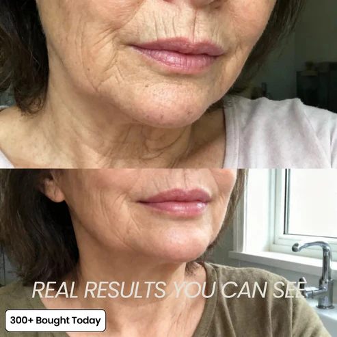 🔥BUY 1 GET IFREE🔥PDRN Pink Collagen Volume Multi Balm